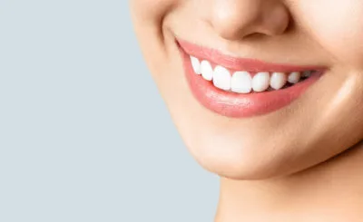 【歯石・黄ばみ除去】吹田市で「歯のクリーニング・歯石取り」を行っている歯医者さん