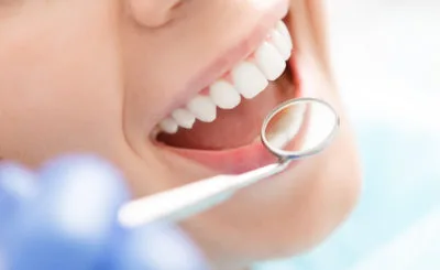 【歯石取り】弁天町駅で歯のクリーニングができる歯医者さん