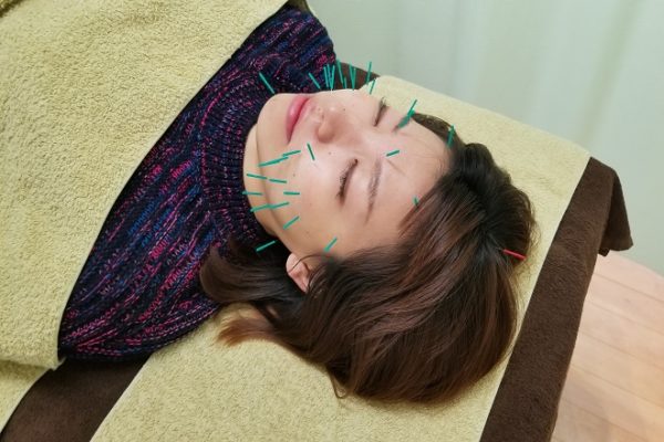 Beauty salon YU-RAKU 北花田 美容鍼