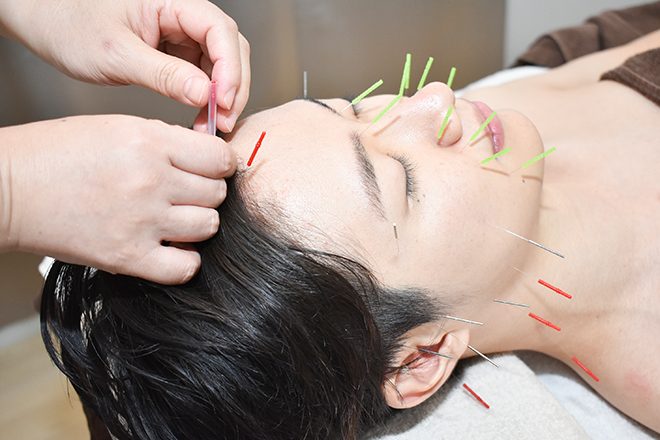 小顔 リフトアップ 淀屋橋 本町エリアでオススメ 美容鍼 3選 マチしる大阪